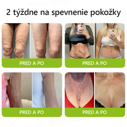 [🔥Last Day 70% OFF] Toclvo® Botox a vitamín A retinolová injekcia - Eraser for Deep Wrinkles, Sagging Jowls & Puffy Eyes