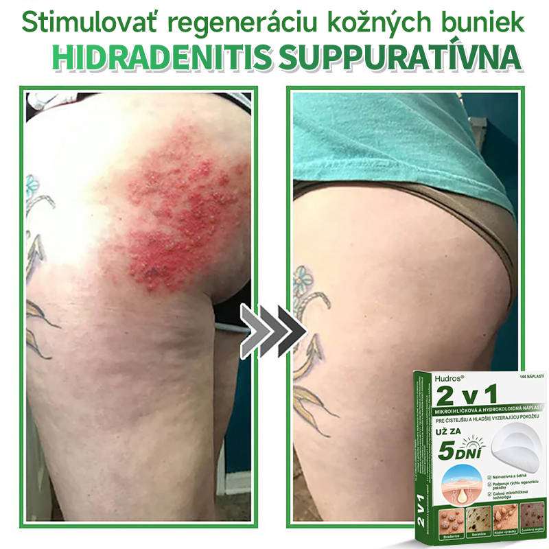🇸🇰 𝐇𝐮𝐝𝐫𝐨𝐬® 💦💦𝟐-𝐯-𝟏 𝐡𝐲𝐝𝐫𝐨𝐤𝐨𝐥𝐨𝐢𝐝𝐧é 𝐧á𝐩𝐥𝐚𝐬𝐭𝐢 𝐬 𝐦𝐢𝐤𝐫𝐨𝐢𝐡𝐥𝐢č𝐤𝐚𝐦𝐢 | Š𝐩𝐞𝐜𝐢á𝐥𝐧𝐞 𝐯𝐲𝐯𝐢𝐧𝐮𝐭é 𝐧𝐚 𝐨𝐝𝐬𝐭𝐫𝐚ň𝐨𝐯𝐚𝐧𝐢𝐞 𝐯𝐲𝐯ýš𝐞𝐧ý𝐜𝐡 𝐦𝐚𝐭𝐞𝐫𝐬𝐤ý𝐜𝐡 𝐳𝐧𝐚𝐦𝐢𝐞𝐧𝐨𝐤, 𝐚𝐤𝐧é, 𝐩𝐥𝐨𝐜𝐡ý𝐜𝐡 𝐛𝐫𝐚𝐝𝐚𝐯í𝐜 𝐚 𝐤𝐨ž𝐧ý𝐜𝐡 𝐯ý𝐫𝐚𝐬𝐭𝐤𝐨𝐯 | 𝐁𝐚𝐥𝐞𝐧𝐢𝐞 𝟏𝟒𝟒 𝐤𝐮𝐬𝐨𝐯🔬🔬