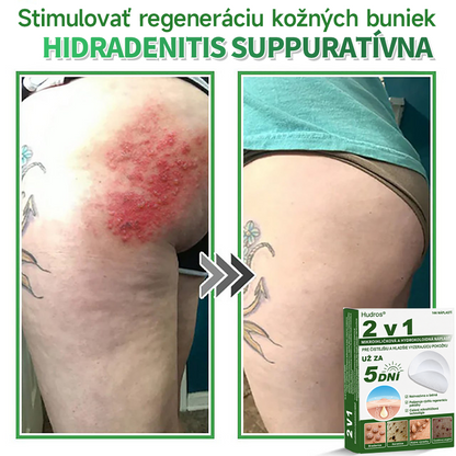 🇸🇰 𝐇𝐮𝐝𝐫𝐨𝐬® 💦💦𝟐-𝐯-𝟏 𝐡𝐲𝐝𝐫𝐨𝐤𝐨𝐥𝐨𝐢𝐝𝐧é 𝐧á𝐩𝐥𝐚𝐬𝐭𝐢 𝐬 𝐦𝐢𝐤𝐫𝐨𝐢𝐡𝐥𝐢č𝐤𝐚𝐦𝐢 | Š𝐩𝐞𝐜𝐢á𝐥𝐧𝐞 𝐯𝐲𝐯𝐢𝐧𝐮𝐭é 𝐧𝐚 𝐨𝐝𝐬𝐭𝐫𝐚ň𝐨𝐯𝐚𝐧𝐢𝐞 𝐯𝐲𝐯ýš𝐞𝐧ý𝐜𝐡 𝐦𝐚𝐭𝐞𝐫𝐬𝐤ý𝐜𝐡 𝐳𝐧𝐚𝐦𝐢𝐞𝐧𝐨𝐤, 𝐚𝐤𝐧é, 𝐩𝐥𝐨𝐜𝐡ý𝐜𝐡 𝐛𝐫𝐚𝐝𝐚𝐯í𝐜 𝐚 𝐤𝐨ž𝐧ý𝐜𝐡 𝐯ý𝐫𝐚𝐬𝐭𝐤𝐨𝐯 | 𝐁𝐚𝐥𝐞𝐧𝐢𝐞 𝟏𝟒𝟒 𝐤𝐮𝐬𝐨𝐯🔬🔬