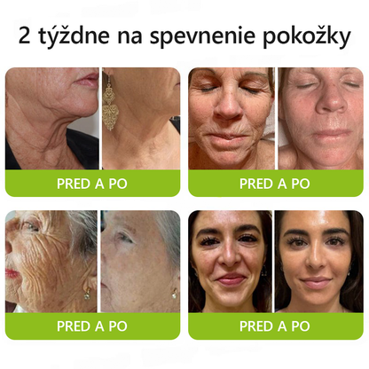 [🔥Last Day 70% OFF] Toclvo® Botox a vitamín A retinolová injekcia - Eraser for Deep Wrinkles, Sagging Jowls & Puffy Eyes