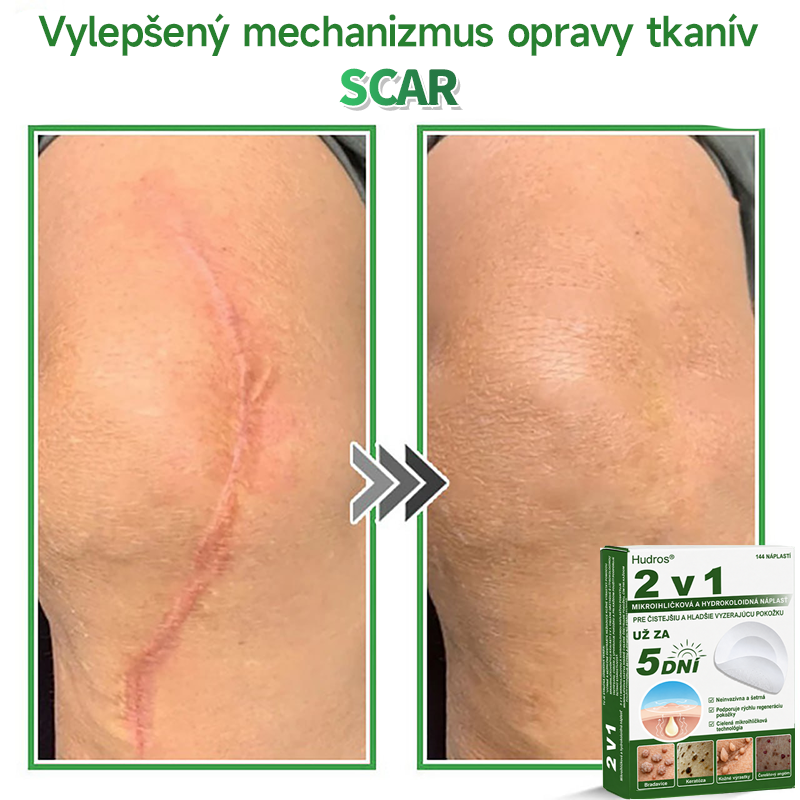 🇸🇰 𝐇𝐮𝐝𝐫𝐨𝐬® 💦💦𝟐-𝐯-𝟏 𝐡𝐲𝐝𝐫𝐨𝐤𝐨𝐥𝐨𝐢𝐝𝐧é 𝐧á𝐩𝐥𝐚𝐬𝐭𝐢 𝐬 𝐦𝐢𝐤𝐫𝐨𝐢𝐡𝐥𝐢č𝐤𝐚𝐦𝐢 | Š𝐩𝐞𝐜𝐢á𝐥𝐧𝐞 𝐯𝐲𝐯𝐢𝐧𝐮𝐭é 𝐧𝐚 𝐨𝐝𝐬𝐭𝐫𝐚ň𝐨𝐯𝐚𝐧𝐢𝐞 𝐯𝐲𝐯ýš𝐞𝐧ý𝐜𝐡 𝐦𝐚𝐭𝐞𝐫𝐬𝐤ý𝐜𝐡 𝐳𝐧𝐚𝐦𝐢𝐞𝐧𝐨𝐤, 𝐚𝐤𝐧é, 𝐩𝐥𝐨𝐜𝐡ý𝐜𝐡 𝐛𝐫𝐚𝐝𝐚𝐯í𝐜 𝐚 𝐤𝐨ž𝐧ý𝐜𝐡 𝐯ý𝐫𝐚𝐬𝐭𝐤𝐨𝐯 | 𝐁𝐚𝐥𝐞𝐧𝐢𝐞 𝟏𝟒𝟒 𝐤𝐮𝐬𝐨𝐯🔬🔬