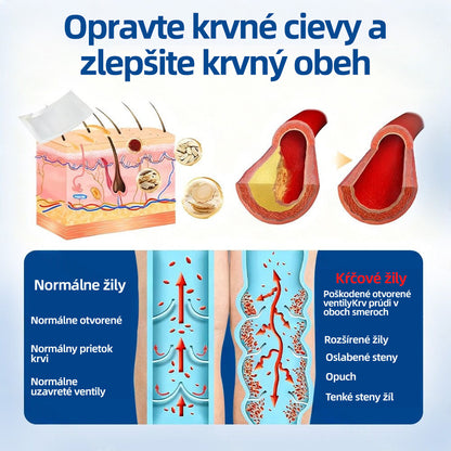 🇸🇰 Healrize® VeinTarget mikrojihlová náplasť 🏆 Okamžitá úľava, dlhodobé výsledky🎀🎀🎀
