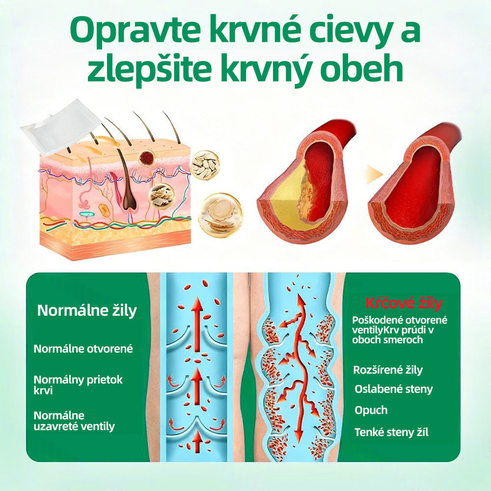 🇸🇰 Healrize® VeinTarget mikrojihlová náplasť 🏆 Okamžitá úľava, dlhodobé výsledky🪇🪇🪇