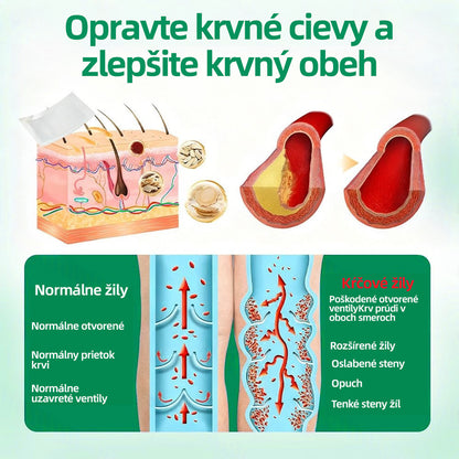 🇸🇰 Healrize® VeinTarget mikrojihlová náplasť 🏆 Okamžitá úľava, dlhodobé výsledky🪇🪇🪇