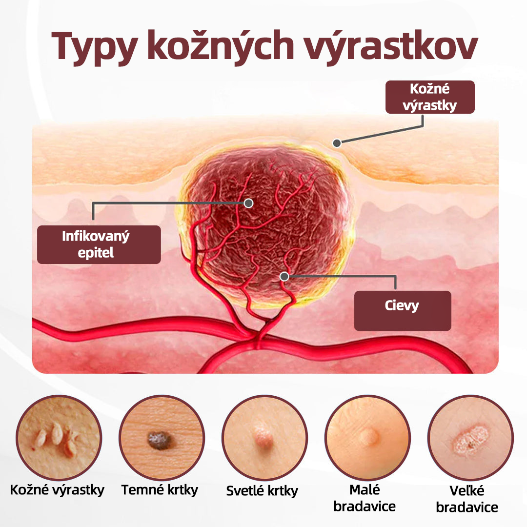 🇸🇰 Dvojčinný obnovovací krém 🧪Curevivo® KeraErase👨‍⚕️