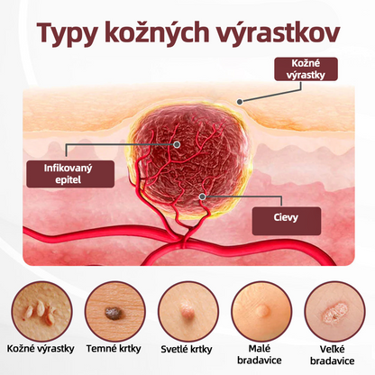 🇸🇰 Dvojčinný obnovovací krém 🧪Curevivo® KeraErase👨‍⚕️